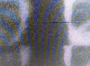 Schroeders